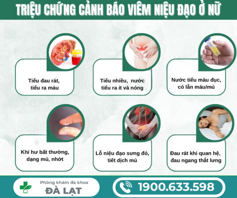 Hình ảnh minh họa